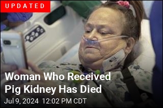 Transplant Patient Loses Her Pig Kidney