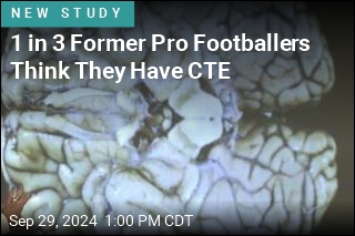 1 in 3 Former Pro Footballers Think They Have CTE