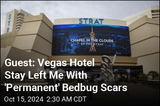 Guest Says Stay at Vegas Hotel Left Her With &#39;Permanent&#39; Bedbug Scars