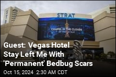 Guest Says Stay at Vegas Hotel Left Her With 'Permanent' Bedbug Scars