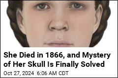 She Died in 1866, and Mystery of Her Skull Is Finally Solved