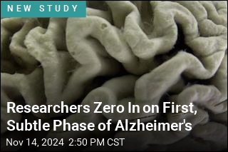 Researchers Zero In on First, Subtle Phase of Alzheimer&#39;s