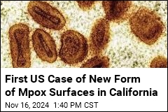 First Case of New Form of Mpox Confirmed in US