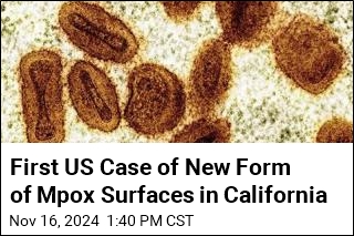 First Case of New Form of Mpox Confirmed in US