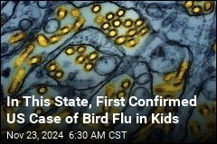 In This State, First Confirmed US Case of Bird Flu in Kids