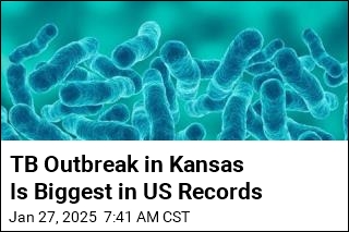 TB Outbreak in Kansas Is Biggest on US Record