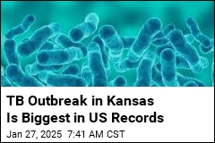 TB Outbreak in Kansas Is Biggest on US Record