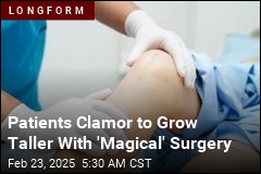 Patients Clamor to Grow Taller With &#39;Magical&#39; Surgery