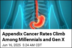 Appendix Cancer Rates Climb Among Millennials and Gen X