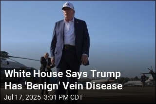 White House Says Trump Has &#39;Common&#39; Vein Disease