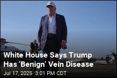White House Says Trump Has &#39;Common&#39; Vein Disease