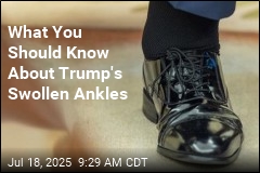 What You Should Know About Trump&#39;s Swollen Ankles