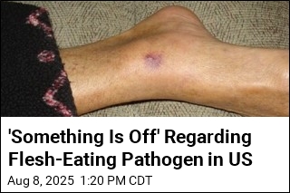Flesh-Eating Bacteria Deaths Surge on Southeast US Coasts