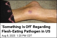 Flesh-Eating Bacteria Deaths Surge on Southeast US Coasts