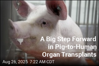 Human Receives Pig Lung in World First