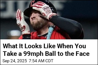 Guardians&#39; Hitter Hospitalized After Ball Slams His Face