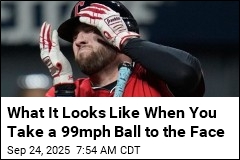 Guardians&#39; Hitter Hospitalized After Ball Slams His Face