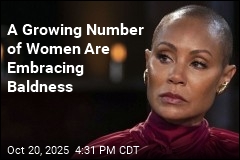 For a Growing Number of Women, Bald Is Beautiful