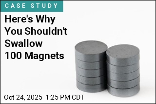 Here&#39;s Why You Shouldn&#39;t Swallow 100 Magnets