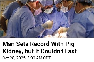Man Sets Record With Pig Kidney, but It Couldn&#39;t Last
