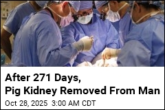 Man Sets Record With Pig Kidney, but It Couldn&#39;t Last
