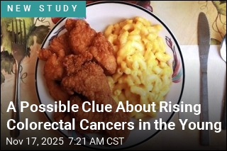 A Possible Clue About Rising Colorectal Cancers in the Young