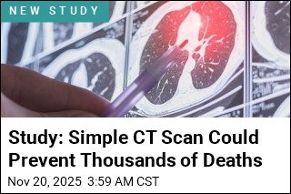 Study: Simple CT Scan Could Prevent Thousands of Deaths