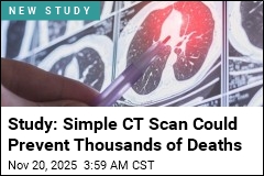 Study: Simple CT Scan Could Prevent Thousands of Deaths