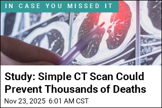 Study: Simple CT Scan Could Prevent Thousands of Deaths