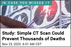 Study: Simple CT Scan Could Prevent Thousands of Deaths