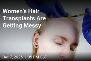 Women&#39;s Hair Transplants Spike, With Unpredictable Results