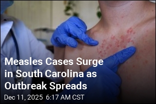 Measles Cases Surge in South Carolina as Outbreak Spreads