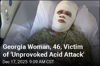 FBI Offers $5K Reward After Acid Attack on Georgia Mom