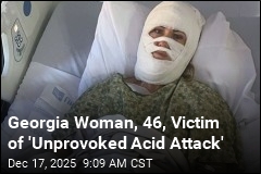 FBI Offers $5K Reward After Acid Attack on Georgia Mom