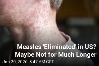After 25 Years, US May Lose 'Eliminated' Status for Measles