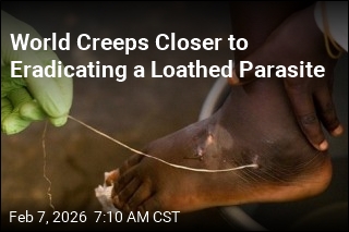 World Closer to Eradicating Jimmy Carter's Loathed Guinea Worm
