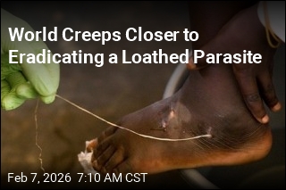 World Closer to Eradicating Jimmy Carter's Loathed Guinea Worm