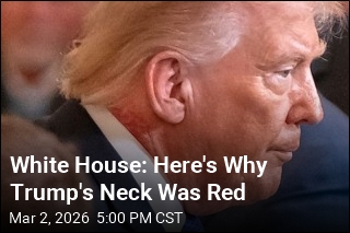 White House Explains Redness on Trump's Neck
