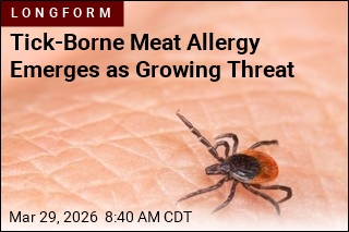 Tick-Borne Meat Allergy Emerges as Growing Threat