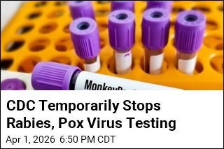 CDC Temporarily Stops Rabies, Pox Virus Testing
