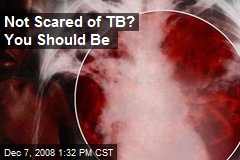 Not Scared of TB? You Should Be