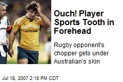 Ouch! Player Sports Tooth in Forehead