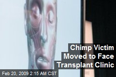 Chimp Victim Moved to Face Transplant Clinic