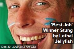'Best Job' Winner Stung by Lethal Jellyfish