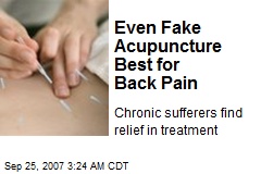 Even Fake Acupuncture Best for Back Pain
