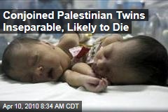 Conjoined Palestinian Twins Inseparable, Likely to Die