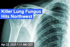 Killer Lung Fungus Hits Northwest