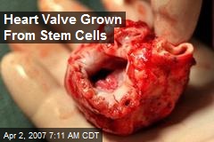 Heart Valve Grown From Stem Cells